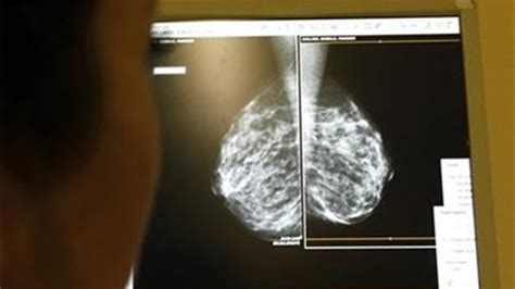 Mammograms May Be Problematic For Women With Dense Breasts Fox News