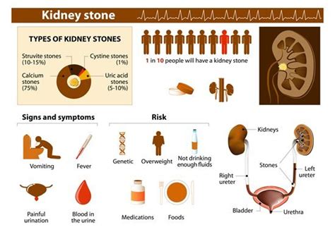 What Causes Kidney Stones In Kids