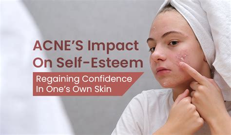 Understanding The Link Between Acne And Self Esteem Acne Wiki