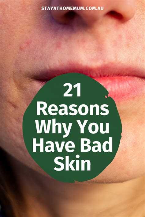 21 Reasons Why You Have Bad Skin