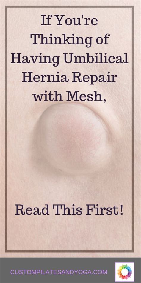 I Was Hesitant To Have Umbilical Hernia Repair With Mesh Was Mesh
