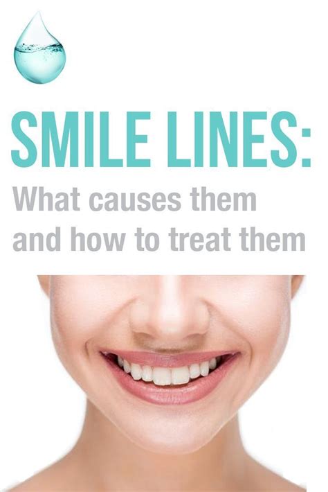 Smile Lines What Causes Them And How To Treat Them Did You Know These