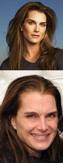 1000 Images About Plastic Surgerygood And Bad On Pinterest Plastic