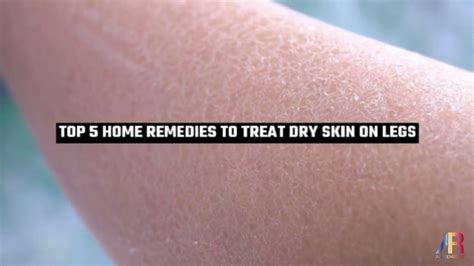 Top 5 Home Remedies To Treat Dry Skin On Legs Youtube