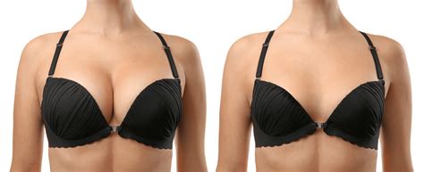 The Many Benefits Of A Breast Reduction Orlando Fl The Institute Of Aesthetic Surgery
