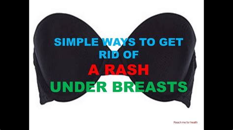 Simple Ways To Get Rid Of A Rash Under Breasts Youtube