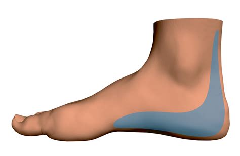 Heel Pain in Beachwood, OH | Erie Foot and Ankle Center
