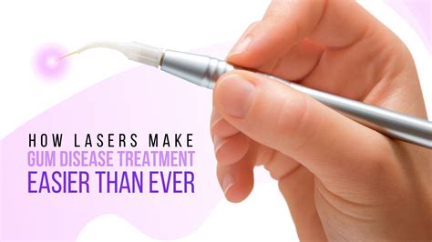 How Lasers Make Gum Disease Treatment Easier Than Ever Periodontics Blog