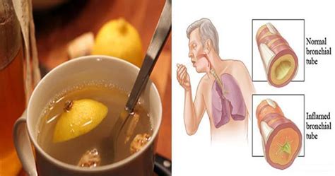 Although no clinical definition exists, clean eating generally refers to how a food is produced. The 3-Ingredient Elixir that Can Clear Mucus from the ...