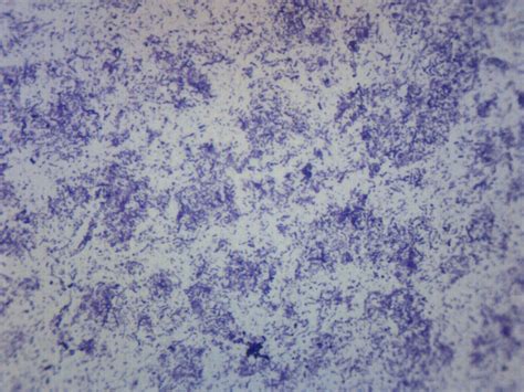 Bacteria Spores Smear Prepared Microscope Slide 75x25mm — Eisco Labs