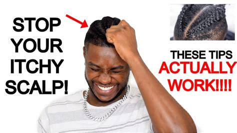 How To Stop Itchy Scalp From Braidscornrows 𝙖𝙡𝙡 𝙩𝙝𝙚 𝙩𝙞𝙥𝙨 𝙮𝙤𝙪 𝙣𝙚𝙚𝙙 𝙩𝙤