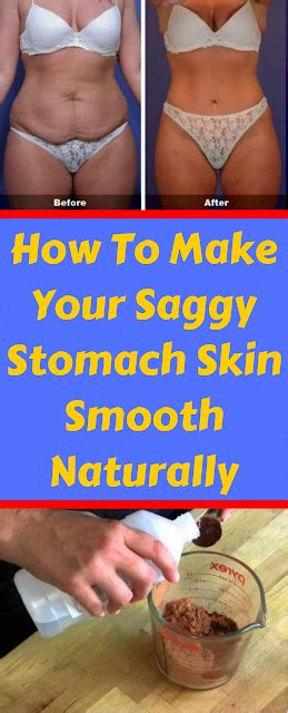The Right Way To Eliminate Saggy Skin On Stomach Howtotightensaggystomachskin Lumpbeneathskin
