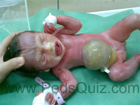 Pediatric Image Quiz A Collection Of Interesting Images In Pediatrics