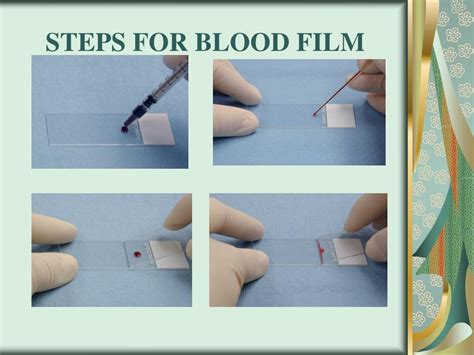 PPT Blood Smear Preparation And Staining PowerPoint Presentation Free Download ID
