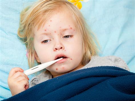 Measles Vaccine Study Findings A Wake Up Call