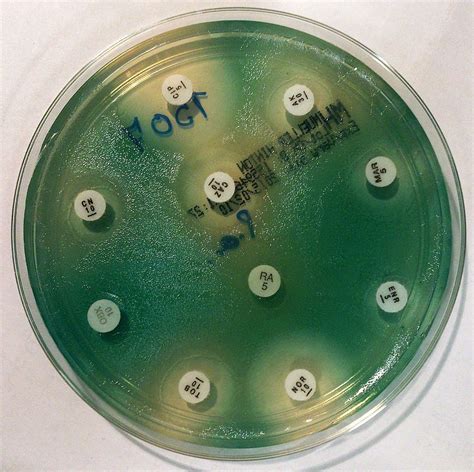 The Antibiogram Of P Aeruginosa On Mueller Hinton Agar Plant Science