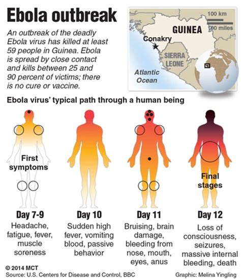 Ebola virus has been found in african monkeys, chimps and other nonhuman primates. Ebola | Infektionserkrankungen