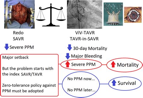 Tavr‐in‐savr Versus Redo Savr Role Of Ppm Ppm Prosthesispatient