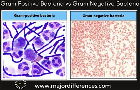 Gram Positive Vs Gram Negative Bacteria How Gram Stain Works