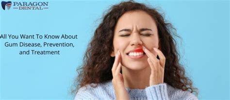 All You Want To Know About Gum Disease Prevention And Treatment