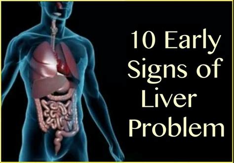 10 early signs of liver problems liver problems signs of liver problems liver