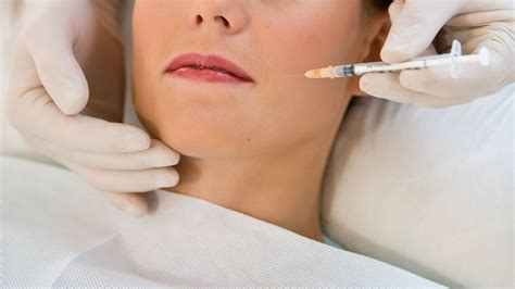 I Had Botox Injections As TMJ Treatment To Reduce My Jaw Pain Allure