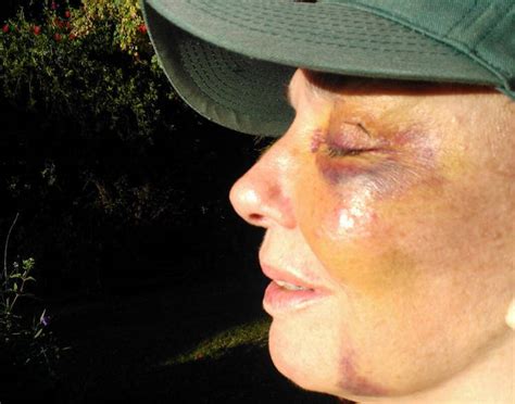 Se verá hoy a las 21 hs, y repite el domingo a las 18 hs. Las secuelas del grave accidente de Graciela Borges - El ...