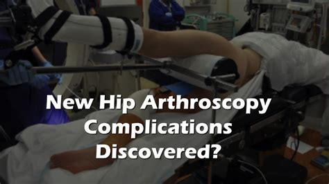 New Hip Arthroscopy Complications Hip Arthroscopy Hips Surface
