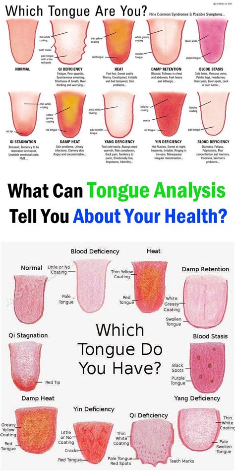 What Does Your Tongue Say About Your Health Health Health Tips