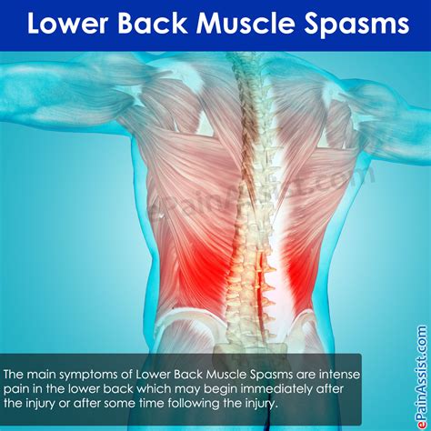 Lower Back Muscle Spasms Treatment Causes Symptoms