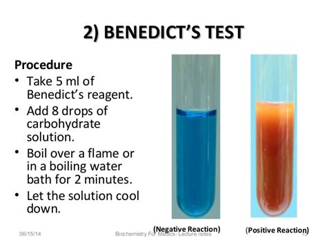 🏆 Benedicts Test Benedicts Reagent 2019 01 15