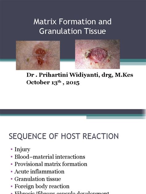 Granulation Tissue 13102015 Pdf Extracellular Matrix Healing