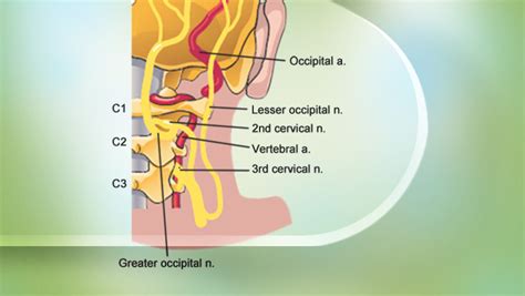 Nerve Block Occipital Nerve Block Technique