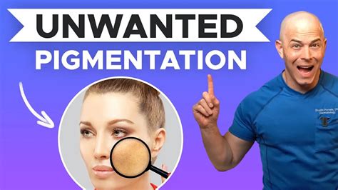 Skin Discoloration Treatment Tips How To Get Rid Of Hyperpigmentation