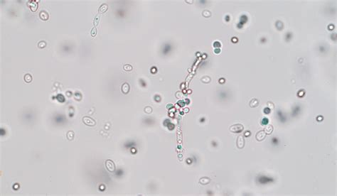 The Counting Yeast Cells Microscope A Brewer’s Must Have