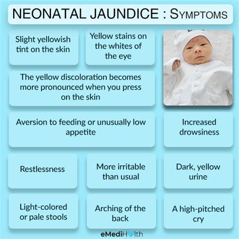 Newborn Jaundice Causes Symptoms Treatment Health Science Bulletin