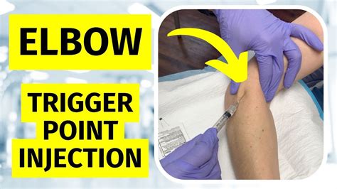 Tennis Elbow Trigger Point Injection Youtube