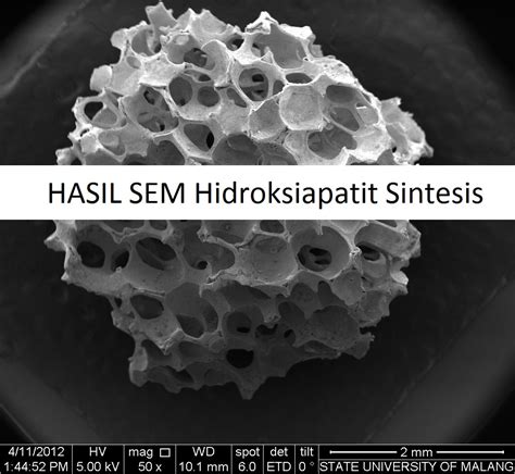 Sem Hidroksiapatit Sintesis Laboratorium Mineral And Material Maju Sentral