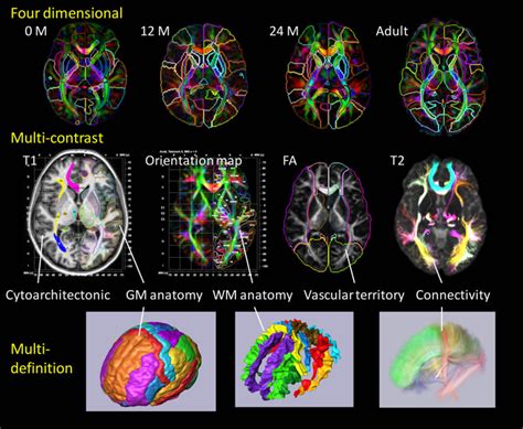 Panels Show A Current Brain Atlas Including 3d Anatomical Information
