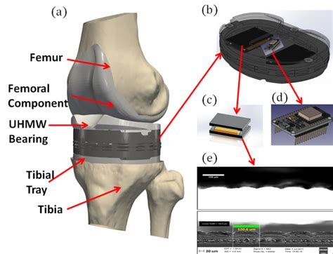 A Smart Knee Implant Using Triboelectric Energy Harvesters