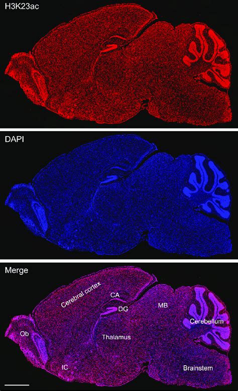 Distribution Of Histone H3k23 Acetylation In The Mouse Brain Adult