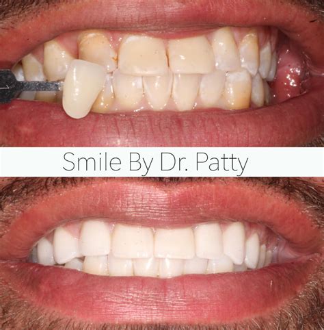 Dr Pattys Dental Boutique And Spa Fort Lauderdale Dentist