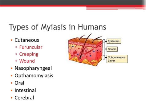 Ppt Myiasis Powerpoint Presentation Free Download Id4553666