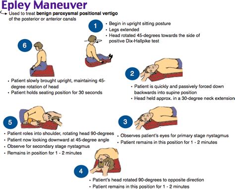 Epley Maneuver Medical Terapia