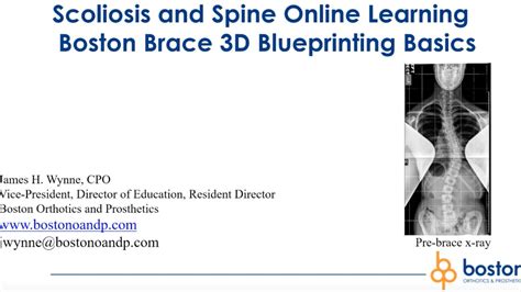 Boston Brace 3d Blueprinting Basics Scoliosis And Spine Online Learning