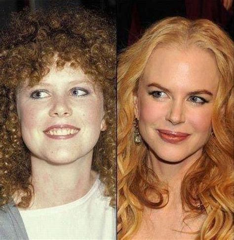 Nicole Kidman | Nicole kidman, Stars then and now, Young celebrities