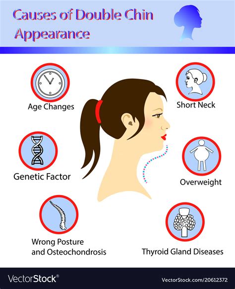 Causes Of Double Chin Royalty Free Vector Image