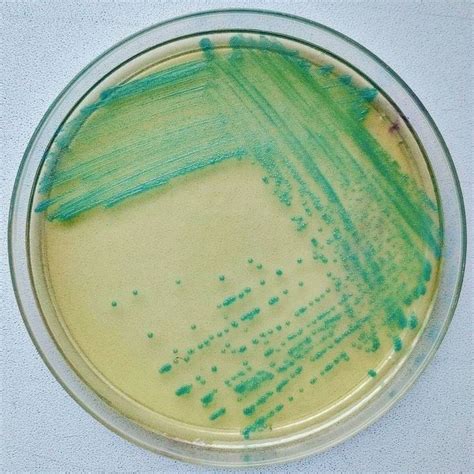 Listeria Monocytogenes Aloa Agar Microbiology Agar Tableware