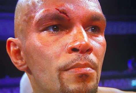 Nationally televised Caleb Truax fight in Minneapolis stopped after accidental head butt - Bring 