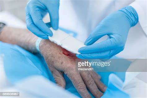 Nurse Dressing A Wound On Patients Hand Stock Foto Getty Images